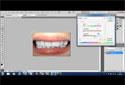 Adobe Photoshop Dersleri / Photoshopta Diş Beyazlatma